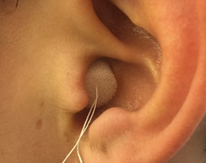 耳型採取6