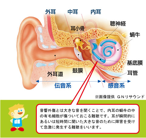 音響外傷と耳の構造