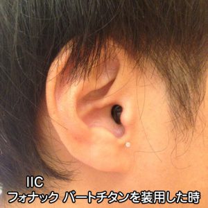 目立たない 補聴器 IIC