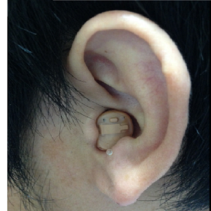 耳あな型補聴器 装用