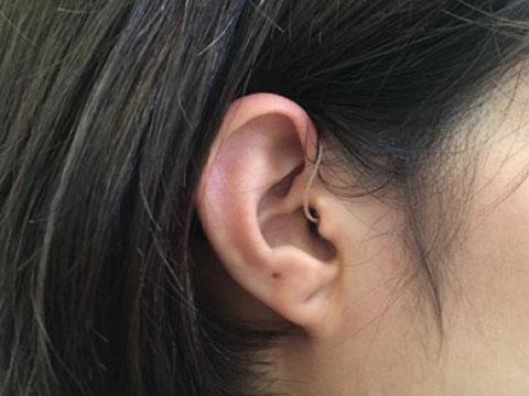 phonak b 4